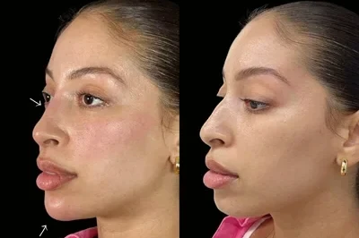 Profile Harmonization miami