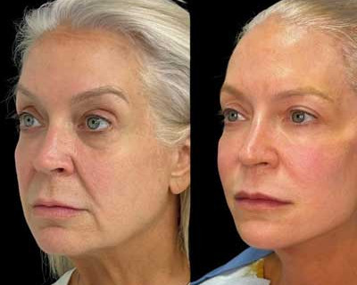 Permanent Threads miami