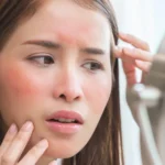 Can You Be Allergic to Botox