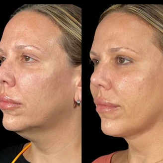 Permanent Threads miami 02