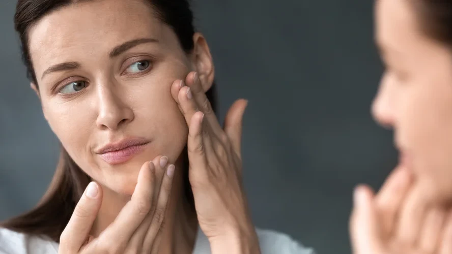 Can Collagen Cause Acne