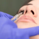 How Old Do You Have to Be to Get Nose Filler