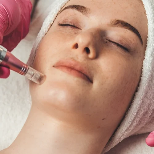 Is Microneedling Permanent Lasting Skin Benefits