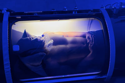 hyperbaric oxygen therapy Miami 01