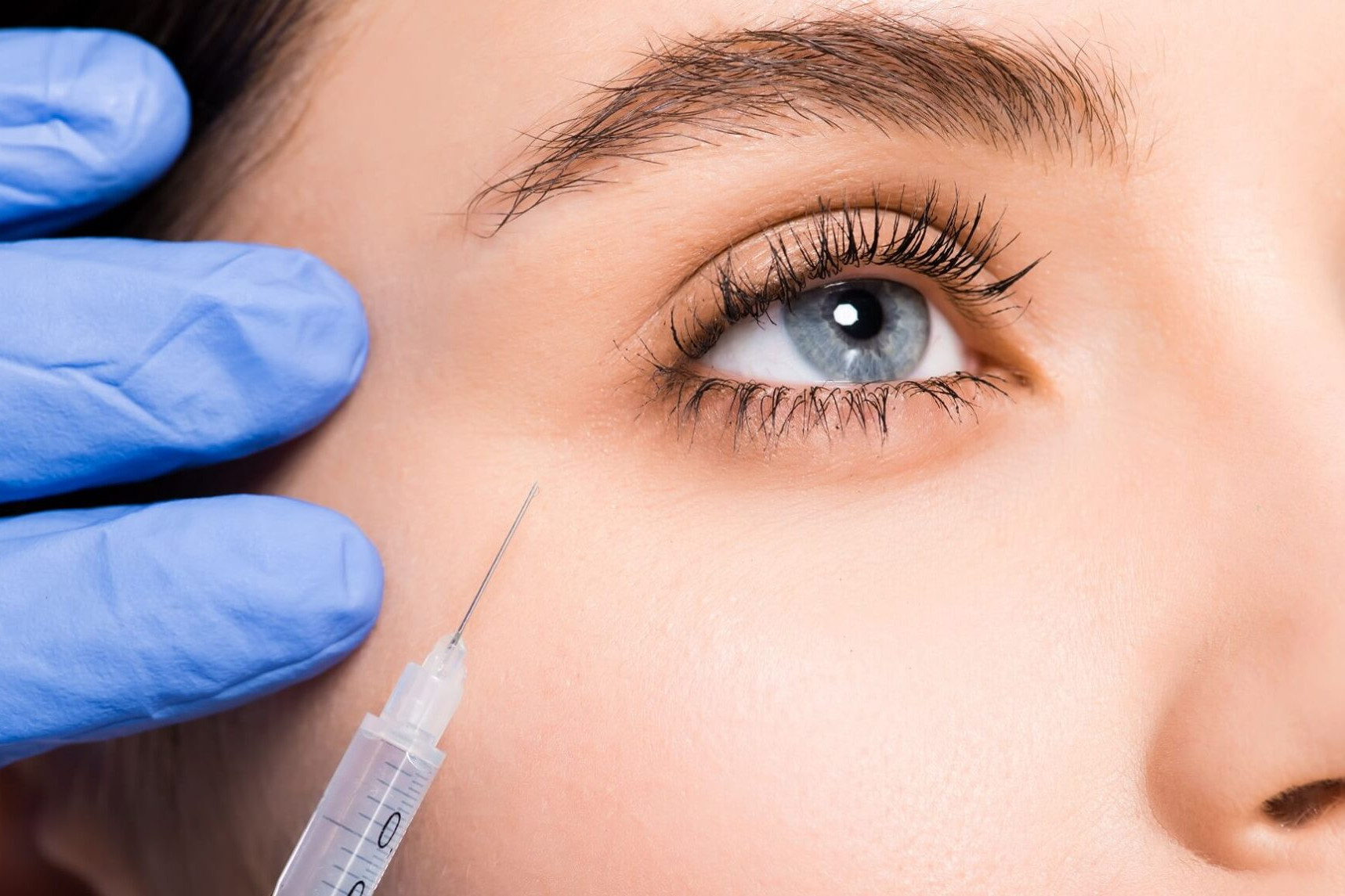 under eye fillers uai